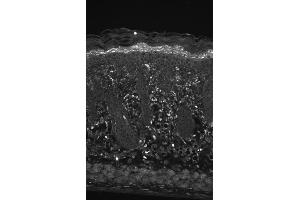 Hsp22 Immunohistochemistry. (HSPB8 抗体)