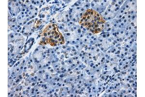 Immunohistochemical staining of paraffin-embedded pancreas tissue using anti-HDAC10mouse monoclonal antibody. (HDAC10 抗体)