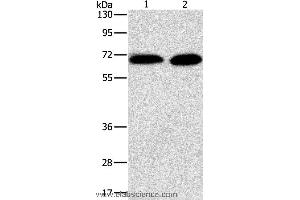 Western blot analysis of Jurkat and NIH/3T3 cell, using PRKCA Polyclonal Antibody at dilution of 1:500 (PKC alpha 抗体)