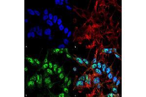 Immunocytochemistry/Immunofluorescence analysis using Rabbit Anti-Beclin 1 Polyclonal Antibody . (Beclin 1 抗体  (APC))