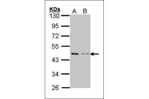 Western blot: Sample (30 µg of whole cell lysate). (beta Actin 抗体)