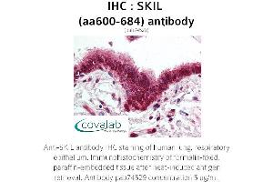 Image no. 1 for anti-SKI-Like Oncogene (SKIL) (AA 600-684) antibody (ABIN1739313) (SKIL 抗体  (AA 600-684))