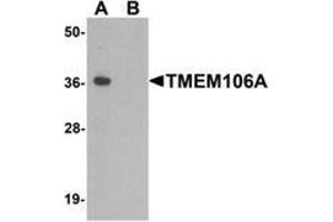 Western blot analysis of TMEM106A in A-20 cell lysate with TMEM106A Antibody  at 1 µg/ml in (A) the absence and (B) the presence of blocking peptide. (TMEM106A 抗体  (N-Term))