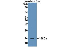 Western blot analysis of the recombinant protein. (SRP9 抗体  (AA 2-86))