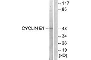 Western blot analysis of extracts from HeLa cells, treated with Paclitaxel 1uM 60', using Cyclin E1 (Ab-395) Antibody. (Cyclin E1 抗体  (AA 361-410))