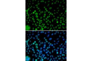 Immunofluorescence analysis of HeLa cells using IRF2 antibody. (IRF2 抗体)