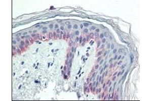 Immunohistochemical analysis of paraffin-embedded human skin tissues using CK5 antibody. (Cytokeratin 5 抗体)