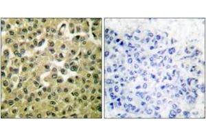 Immunohistochemistry (IHC) image for anti-Induced Myeloid Leukemia Cell Differentiation Protein Mcl-1 (MCL1) (AA 91-140) antibody (ABIN2889222) (MCL-1 抗体  (AA 91-140))