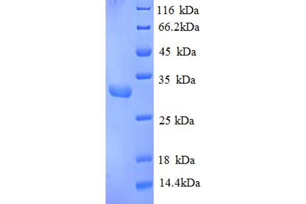 RPA4 Protein (AA 1-260, partial) (His tag)