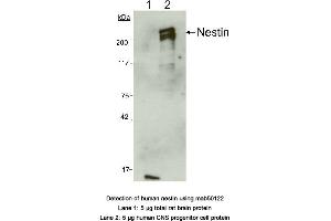 Image no. 2 for anti-Nestin (NES) (AA 1464-1614) antibody (ABIN363276) (Nestin 抗体  (AA 1464-1614))