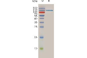 SPAM1 Protein (AA 36-482) (Fc Tag)