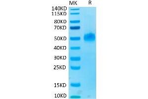 SDS-PAGE (SDS) image for Poliovirus Receptor-Related Immunoglobulin Domain Containing (PVRIG) protein (mFc Tag) (ABIN7275506)