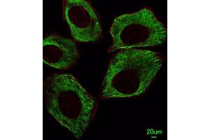 Immunofluorescence (IF) image for anti-Tubulin, beta (TUBB) antibody (ABIN5014943) (TUBB 抗体)