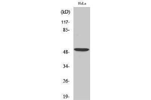 Western Blotting (WB) image for anti-Activating Transcription Factor 2 (ATF2) (Ser220), (Ser259) antibody (ABIN3179881) (ATF2 抗体  (Ser220, Ser259))