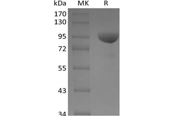 EPH Receptor B1 Protein (EPHB1) (Fc Tag)