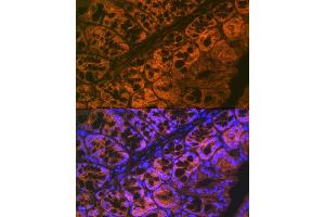 Immunofluorescence analysis of mouse large intestine using  Rabbit mAb (ABIN7265434) at dilution of 1:100 (40x lens). (ADAM15 抗体)