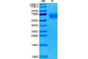 Cynomolgus TYRO3 on Tris-Bis PAGE under reduced condition. (TYRO3 Protein (AA 41-427) (His tag))