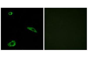 Immunofluorescence analysis of MCF-7 cells, using ACTHR antibody. (MC2R 抗体  (C-Term))