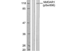 Western blot analysis of extract from MCF7 cells, untreated or treated with estradiol (100nM, 20min), using NMDAR1 (phospho-Ser896) antibody (E011104). (GRIN1/NMDAR1 抗体  (pSer896))