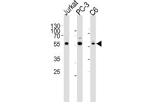Western blot analysis of lysates from Jurkat, PC-3, C6 cell line (from left to right), using AKT1/2/3 Antibody (Center) (ABIN6244286 and ABIN6577440). (AKT 1/2/3 抗体  (AA 278-312))