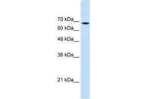Western Blotting (WB) image for anti-Transglutaminase 2 (C Polypeptide, Protein-Glutamine-gamma-Glutamyltransferase) (TGM2) antibody (ABIN2463067) (Transglutaminase 2 抗体)