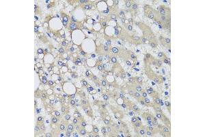 Immunohistochemistry of paraffin-embedded human liver injury using PRODH antibody at dilution of 1:100 (x40 lens). (PRODH 抗体)