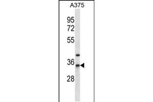 Western blot analysis in A375 cell line lysates (35ug/lane). (NAT1 抗体  (AA 102-130))