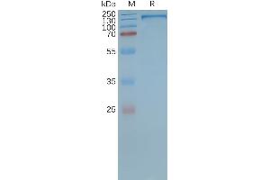 Human MDR-1-Nanodisc, Flag Tag on SDS-PAGE (Malic Enzyme Complex, Mitochondrial (Mod2) 蛋白)