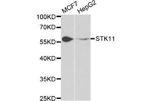 Western blot analysis of extracts of MCF7 and HepG2 cell lines, using STK11 antibody. (LKB1 抗体)