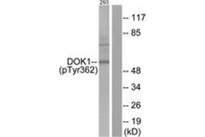 Western Blotting (WB) image for anti-Docking Protein 1, 62kDa (Downstream of tyrosine Kinase 1) (DOK1) (pTyr362) antibody (ABIN2888393) (DOK1 抗体  (pTyr362))