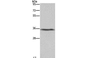 Western Blot analysis of Human fetal liver tissue using DDAH1 Polyclonal Antibody at dilution of 1:400 (DDAH1 抗体)