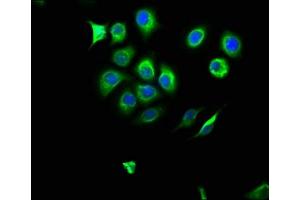 Immunofluorescence staining of A549 cells with ABIN7161627 at 1:166, counter-stained with DAPI. (NOS2 抗体  (AA 17-141))