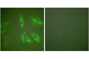 Immunofluorescence analysis of HeLa cells, using Gastrin Antibody. (Gastrin 抗体  (AA 52-101))