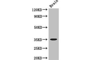 Western Blot Positive WB detected in: Mouse brain tissue All lanes: MYOD1 antibody at 3 μg/mL Secondary Goat polyclonal to rabbit IgG at 1/50000 dilution Predicted band size: 35 kDa Observed band size: 35 kDa (MYOD1 抗体  (AA 116-320))