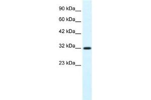 WB Suggested Anti-COLQ Antibody Titration:  0. (COLQ 抗体  (N-Term))