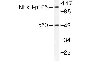 Image no. 2 for anti-Nuclear Factor of kappa Light Polypeptide Gene Enhancer in B-Cells 1 (NFKB1) antibody (ABIN271744) (NFKB1 抗体)