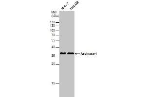 Western Blotting (WB) image for anti-Arginase, Liver (ARG1) antibody (ABIN2856661)