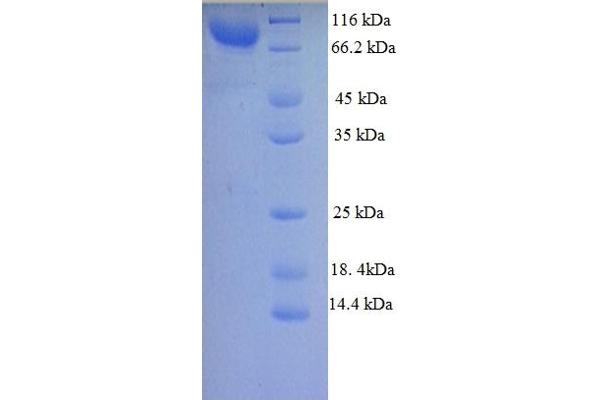 FRZB Protein (AA 39-760) (GST tag)