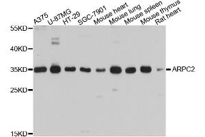 Western blot analysis of extracts of various cell lines, using ARPC2 antibody. (ARPC2 抗体)