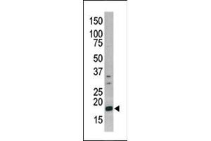 Image no. 1 for anti-Histone 3 (H3) (pSer10) antibody (ABIN358062) (Histone 3 抗体  (pSer10))