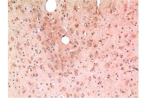 Immunohistochemical analysis of paraffin-embedded Rat Brain Tissue using TGFβ1 Mouse mAb diluted at 1:200. (TGFB1 抗体)