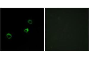 Image no. 2 for anti-Cytochrome B-561 Domain Containing 1 (CYB561D1) (AA 180-229) antibody (ABIN2889869) (CYB561D1 抗体  (AA 180-229))