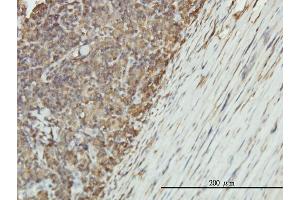 Immunostaining (ISt) image for anti-Enolase 1 (ENO1) (AA 1-434) antibody (ABIN560741)