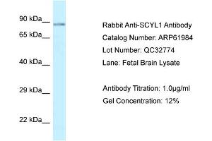 Western Blotting (WB) image for anti-SCY1-Like 1 (SCYL1) (C-Term) antibody (ABIN786532) (SCYL1 抗体  (C-Term))