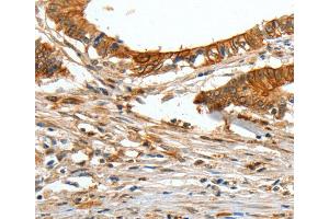 Immunohistochemistry (IHC) image for anti-Collagen, Type I, alpha 2 (COL1A2) antibody (ABIN2421212) (COL1A2 抗体)