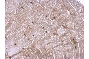 Immunohistochemistry (IHC) image for anti-CREB Binding Protein (CREBBP) (C-Term) antibody (ABIN2854987)