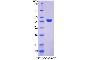 SDS-PAGE (SDS) image for Amphiphysin (AMPH) (AA 24-240) protein (His tag) (ABIN4989064) (Amphiphysin Protein (AMPH) (AA 24-240) (His tag))