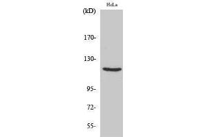 Western Blotting (WB) image for anti-PR (Thr229) antibody (ABIN3176998) (PR (Thr229) 抗体)