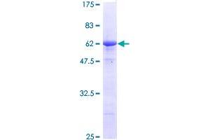 Image no. 1 for Stanniocalcin 2 (STC2) (AA 1-302) protein (GST tag) (ABIN1321620) (Stanniocalcin 2 Protein (STC2) (AA 1-302) (GST tag))