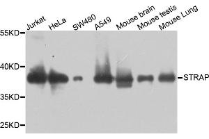 Western blot analysis of extracts of various cell lines, using STRAP antibody. (STRAP 抗体)